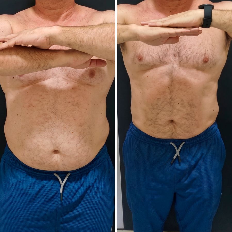Antes e depois, resultado real de paciente da Clínica YK